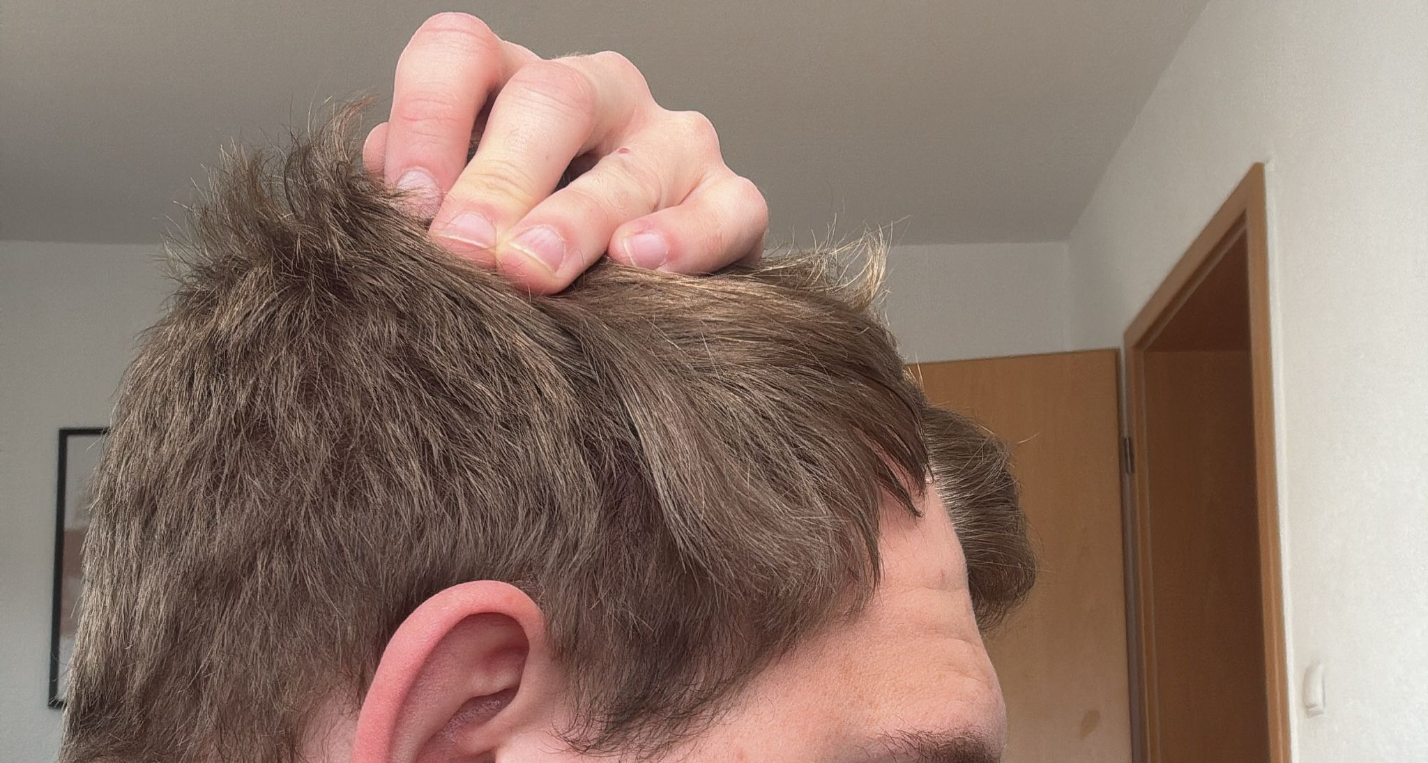 Farbabgleich am Seitenhaar mittels Farbring