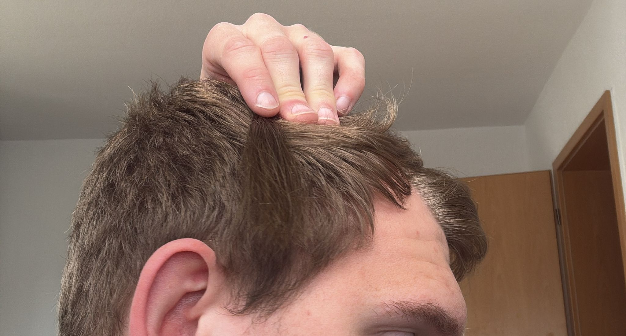 Farbabgleich am Seitenhaar mittels Farbring