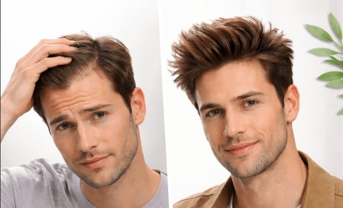 Dünnes Haar gegen volles Haar