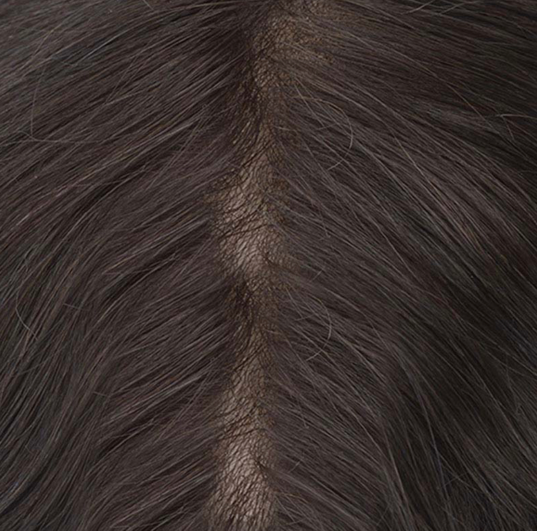Haarsystem, Natürlicher Haaransatz